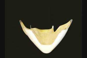 Verkleidungen vorderer ohne Hoecker