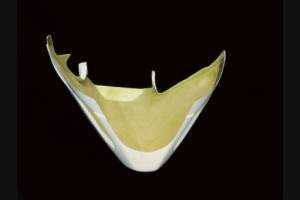 Verkleidungen ohne Kotflugel